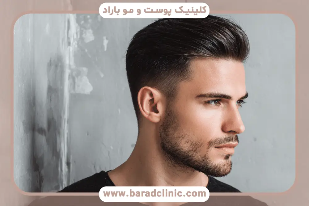 مراقبت‌های قبل و بعد بهترین کاشت مو در ایران