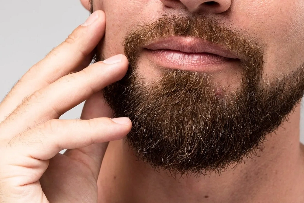 راهنمای مشاوره رایگان کاشت ریش به روش سوپر SUT