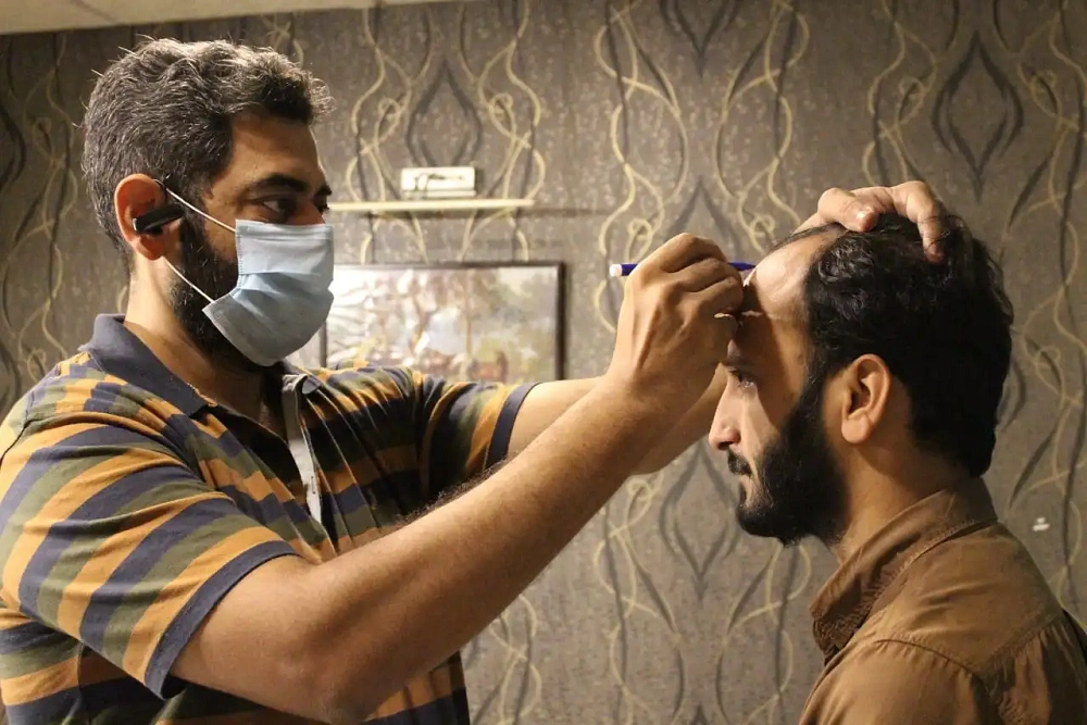 مشاوره کاشت مو در تهران؛ راهنمای کامل انتخاب بهترین روش و کلینیک