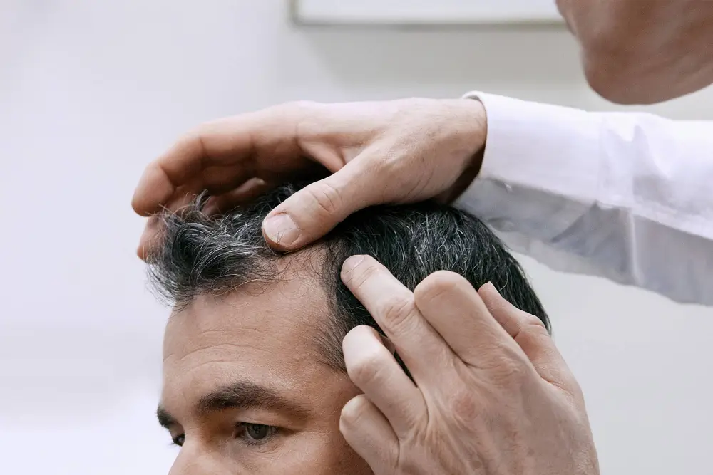 مشاوره رایگان کاشت مو در بهترین کلینیک تهران، اولین قدم برای انتخابی مطمئن